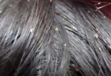 ELEVII AU ÎNCEPUT ȘCOALA CU… PĂDUCHI