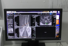 SJU SLATINA: ECHIPAMENTE PENTRU TRATAREA PACIENȚILOR ONCOLOGICI