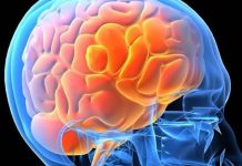 Ziua Mondială a Creierului