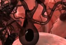 MEDICII RECOMANDĂ O DERMATOSCOPIE PE AN