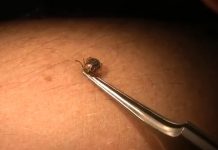 21 PERSOANE DIN OLT, MUȘCATE DE CĂPUȘE