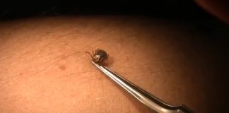 21 PERSOANE DIN OLT, MUȘCATE DE CĂPUȘE