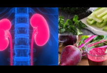 CUM PREVENIM APARIȚIA PIETRELOR LA RINICHI?