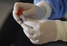 În laboratorul DSVSA Olt au fost făcute 17 teste pentru SARS-CoV2