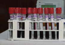 OLTENII VINDECAȚI ÎI POT SALVA PE CEI CARE AU COVID 19