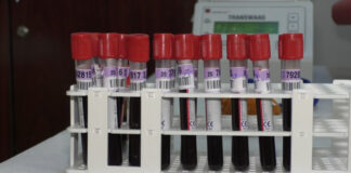 OLTENII VINDECAȚI ÎI POT SALVA PE CEI CARE AU COVID 19