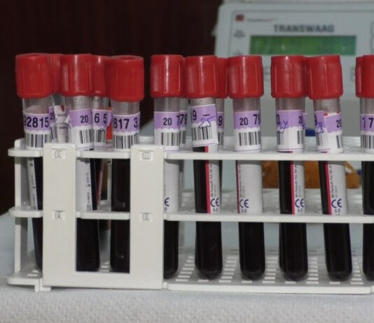 OLTENII VINDECAȚI ÎI POT SALVA PE CEI CARE AU COVID 19