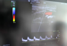 MEDICII, ÎNGRIJORAŢI PENTRU PACIENŢII TINERI CU AVC